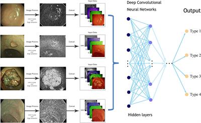 Real-Time Artificial Intelligence-Based Histologic Classifications of Colorectal Polyps Using Narrow-Band Imaging